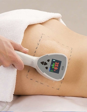 Giảm Mỡ Công Nghệ EXILIS ULTRA